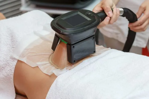 Image of person having fat freezing treatment to help weight gain Accrington