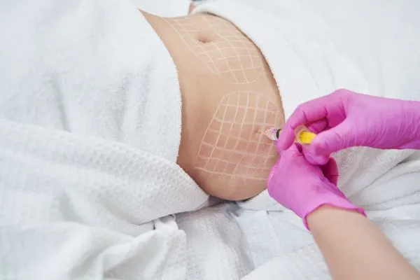 image of fat dissolving injections on love handles to help combat weight gain Accrington
